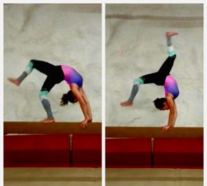 spondylolyysi ja spondylolisteesi